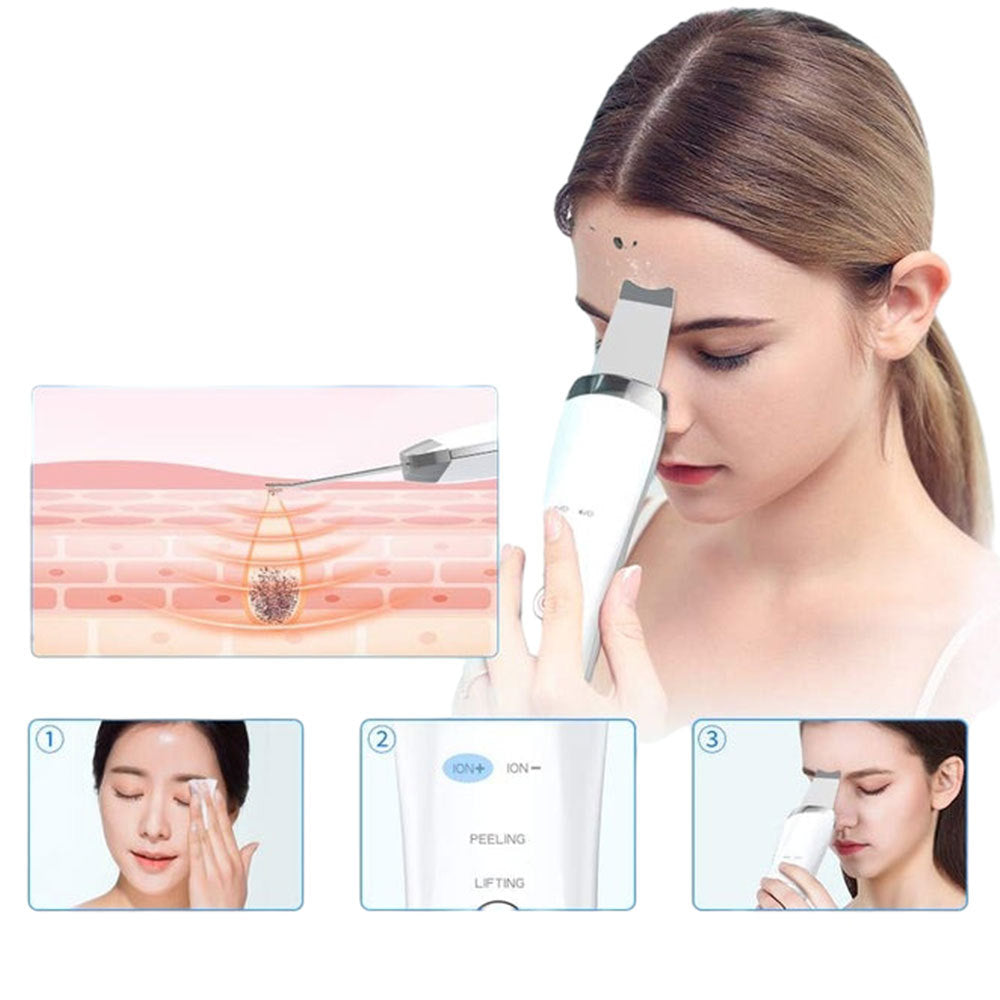 Electric Ultrasonic Skin Scrubber Face Spatula Home Ultrasonic Skin Scrubber Facial Cleaner Handheld Mini Derma Galvanica Tightening Face Scrubber Machine Skin Scrubber USB Ultrasonic - URBAN METRO
